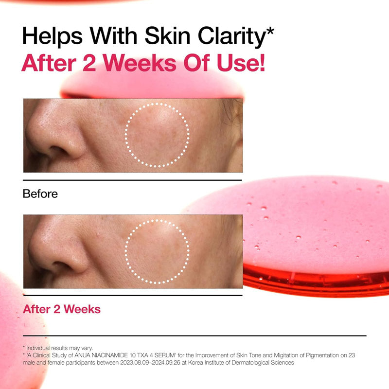 Anua Niacinamide 10% + TXA 4% Sérum Correcteur de Tâches 30 ml